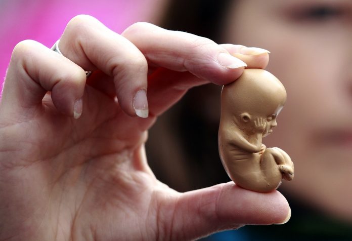 A pro-life campaigner holds up a model of a 12-week-old embryo during a protest outside the Marie Stopes clinic in Belfast